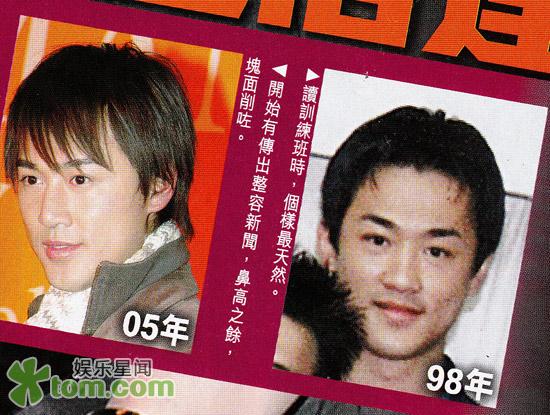 林峰变脸六年五官愈发精致 再度扩建下巴催运(图)