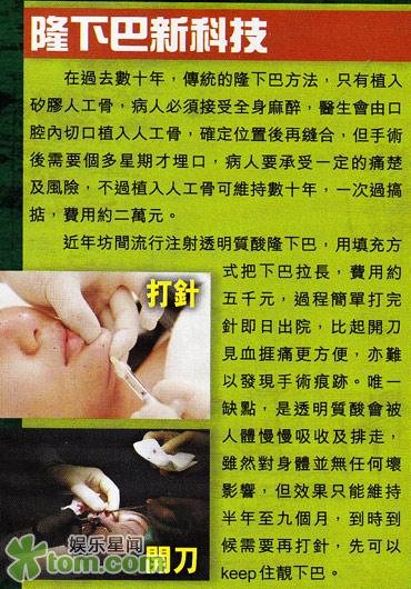 林峰变脸六年五官愈发精致 再度扩建下巴催运(图)