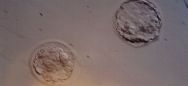 生命的延续——“胚胎收养”