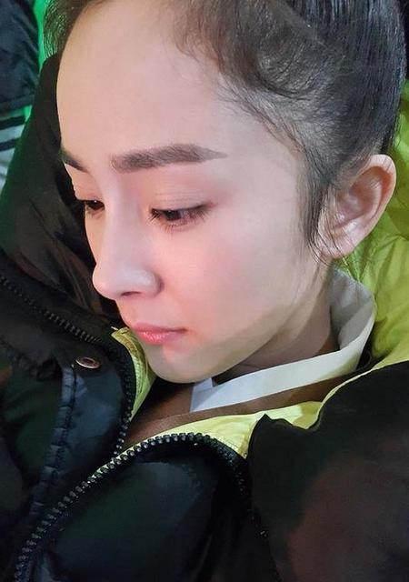杨幂发际线被吐槽：这是秃出新境界