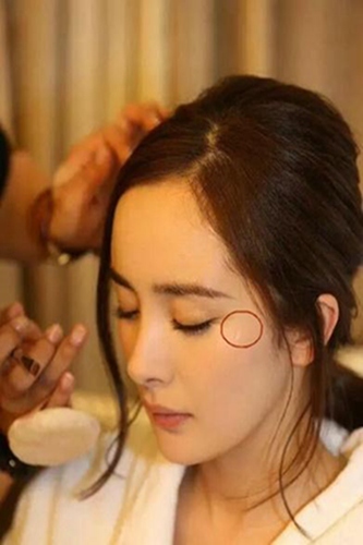 杨幂脸上的疤痕这么奇葩,而孙俪嘴上的玻璃过了十年才