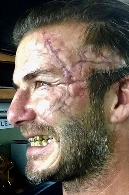 贝克汉姆带疤毁容牙齿又黄又丑 原来是客串《亚瑟王》