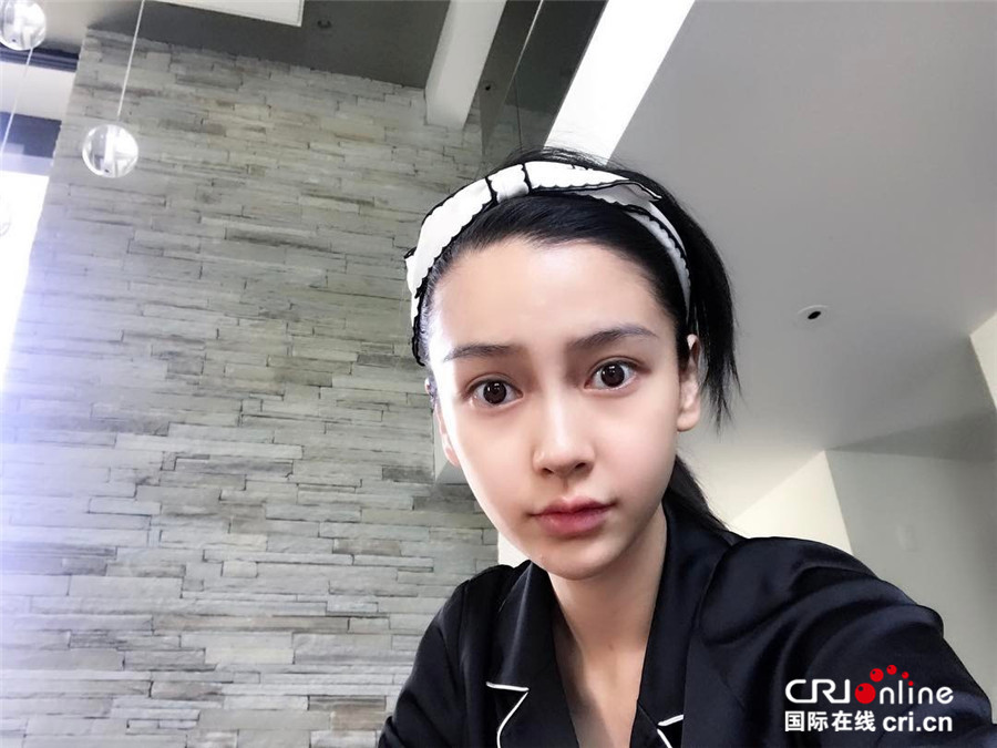 赵丽颖佟丽娅杨幂Angelababy真实皮肤最好的竟是她