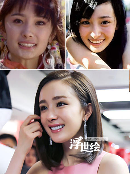 杨幂杨洋唐嫣郑爽都整过 矫正牙齿堪比整容
