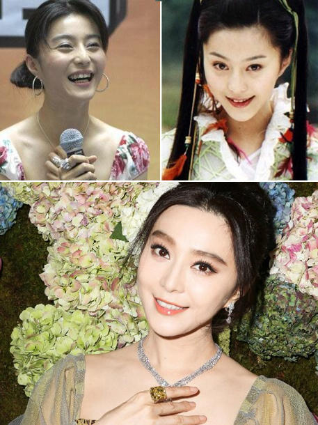 杨幂杨洋唐嫣郑爽都整过 矫正牙齿堪比整容