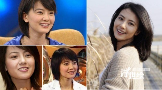 杨幂杨洋唐嫣郑爽都整过 矫正牙齿堪比整容