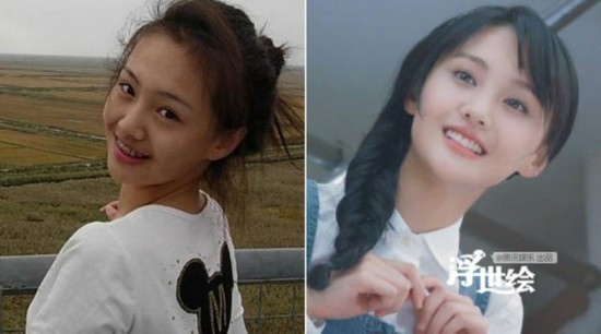 杨幂杨洋唐嫣郑爽都整过 矫正牙齿堪比整容
