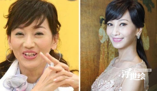杨幂杨洋唐嫣郑爽都整过 矫正牙齿堪比整容