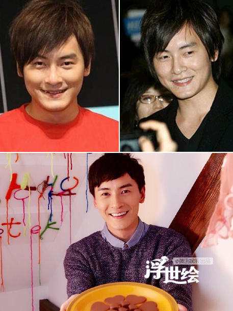 杨幂杨洋唐嫣郑爽都整过 矫正牙齿堪比整容