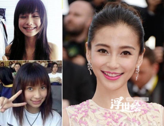 杨幂杨洋唐嫣郑爽都整过 矫正牙齿堪比整容