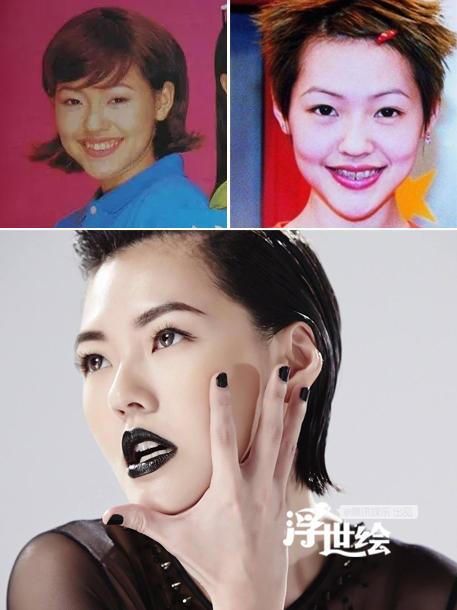 杨幂杨洋唐嫣郑爽都整过 矫正牙齿堪比整容