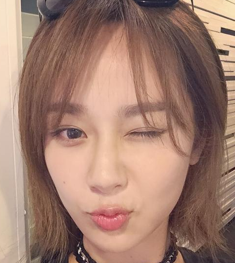 杨紫得荨麻疹 脸部红肿亮红灯网友心疼支招望