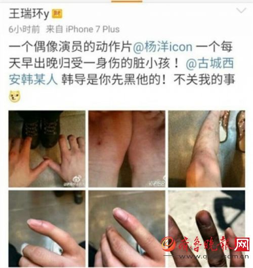 心在滴血！《武动乾坤》导演晒杨洋受伤照 杨洋坚决不用替身