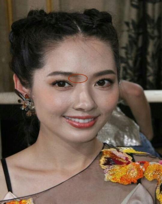 明星脸上的不完美：杨幂脸上有疤 孙俪嘴上刺玻璃渣